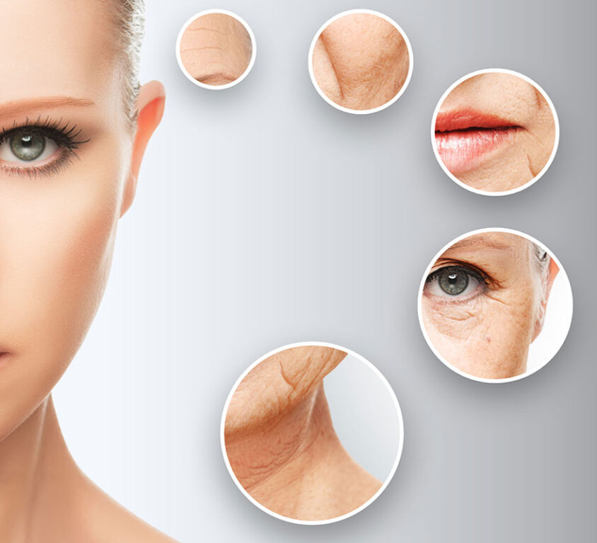 Rejuvenecimiento facial 3D