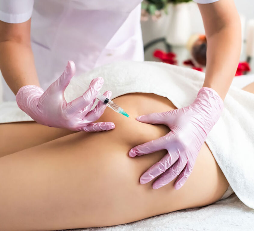 Implantes de relleno