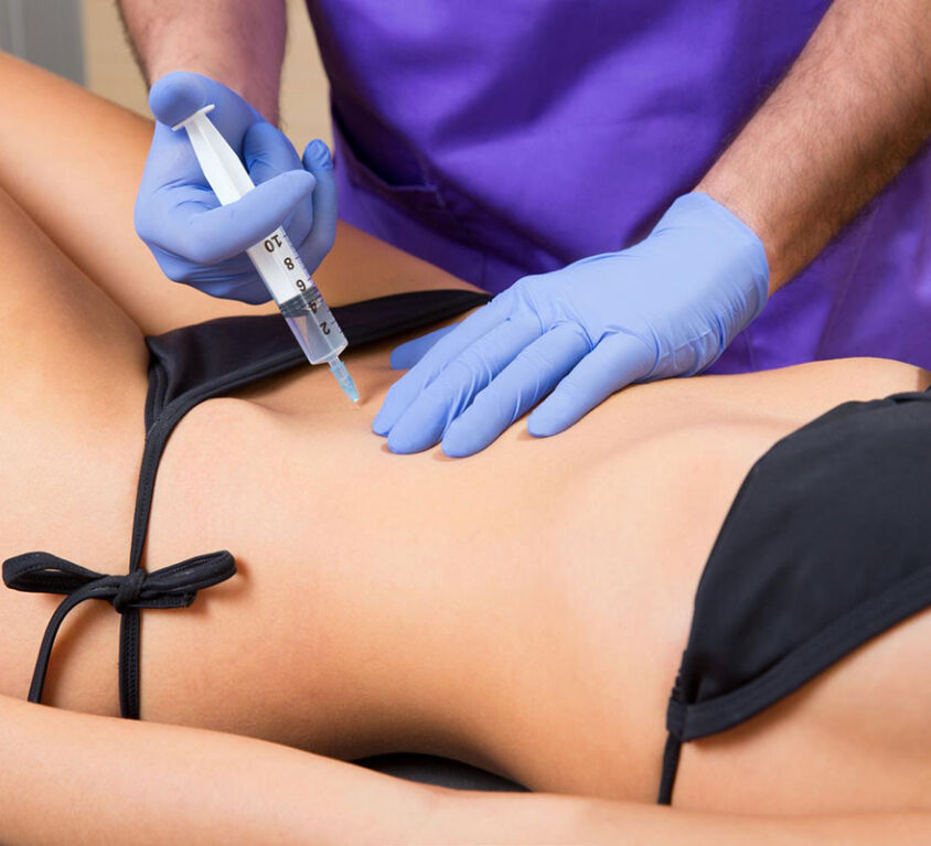 Mesoterapia
