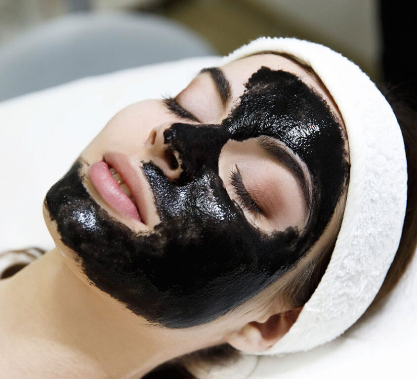 Peeling láser con carbón activo