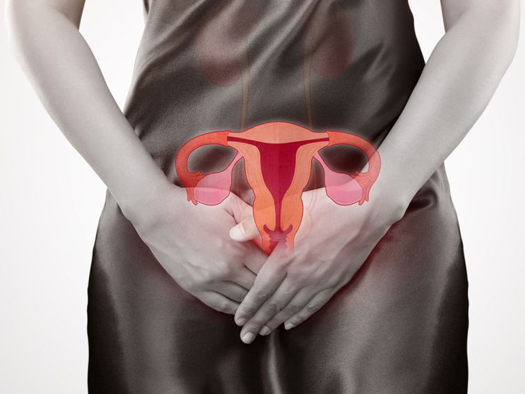 Tratamiento del Síndrome urogenital con radiofrecuencia